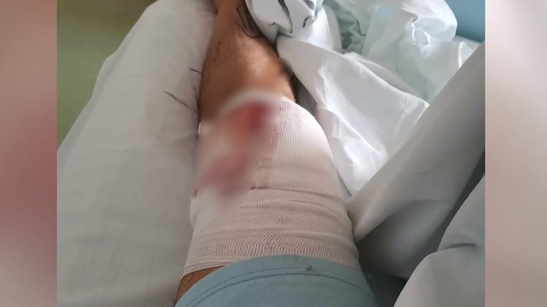 Άνω Λιόσια: Αδέσποτη σφαίρα τραυμάτισε κάτοικο στο μπαλκόνι του σπιτιού του